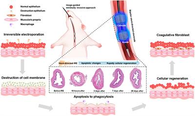 Image-guided stent-directed irreversible electroporation for circumferential ablation in the rat esophagus